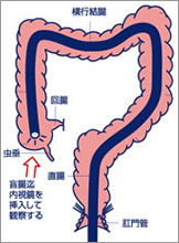 名古屋市 中村内科クリニック 胃カメラ