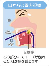 名古屋市 中村内科クリニック 胃カメラ