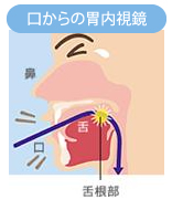 名古屋市 中村内科クリニック 胃カメラ