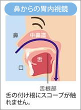 名古屋市 中村内科クリニック 胃カメラ